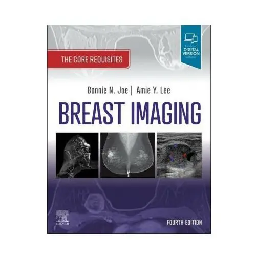 Elsevier - health sciences division Breast imaging