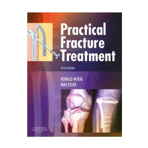 Practical Fracture Treatment