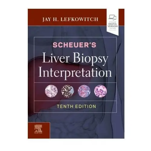 Scheuer's liver biopsy interpretation Elsevier health sciences