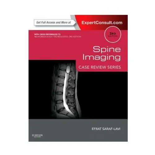 Spine Imaging: Case Review Series