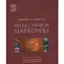 Atlas chorób siatkówki Elsevier urban&partner Sklep on-line