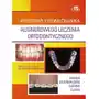 Elsevier wydawnictwo Podstawy i biomechanika alignerowego leczenia ortodontycznego Sklep on-line
