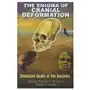 Enigma of Cranial Deformation Sklep on-line