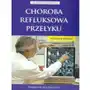 Choroba refluksowa przełyku Sklep on-line