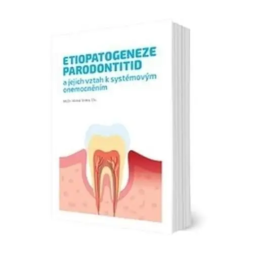 Etiopatogeneze parodontitid a jejich vztah k systémovým onemocněním Straka, Michal