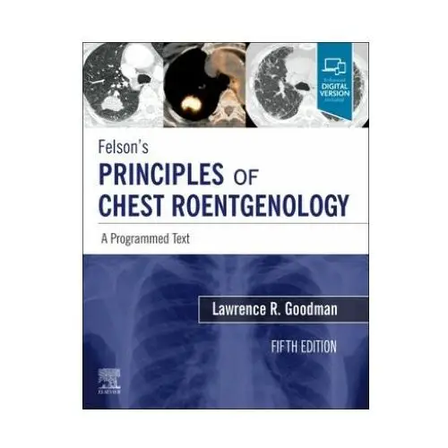 Felson's Principles of Chest Roentgenology, A Programmed Text