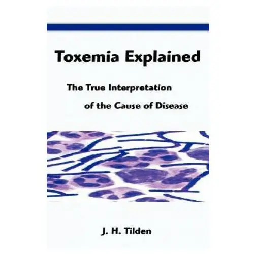 Toxemia explained: the true interpretation of the cause of disease Filiquarian pub llc