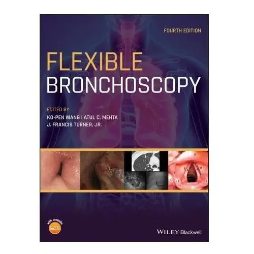 Flexible bronchoscopy Wang, yunpeng; tian, daxin; sheng, zhengguo; jian, wang