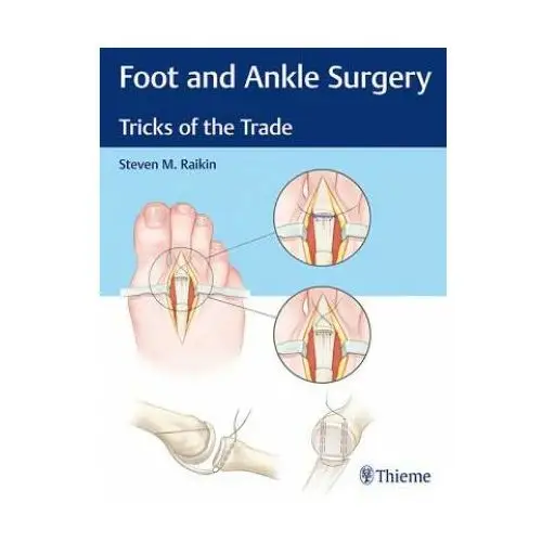 Foot and ankle surgery Thieme medical publishers inc