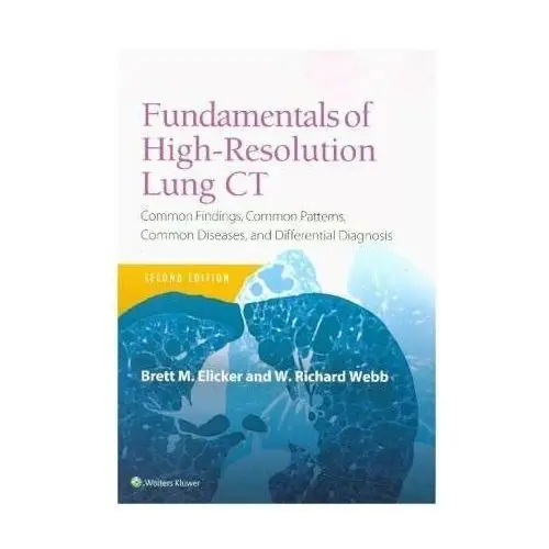 Fundamentals of High-Resolution Lung CT