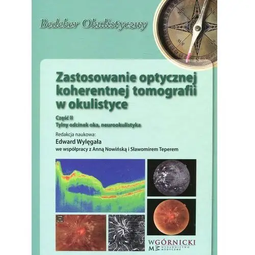 Zastosowanie optycznej koherentnej tomografii w okulistyce część 2 - edward wylęgała, nowińska anna, teper sławomir Górnicki