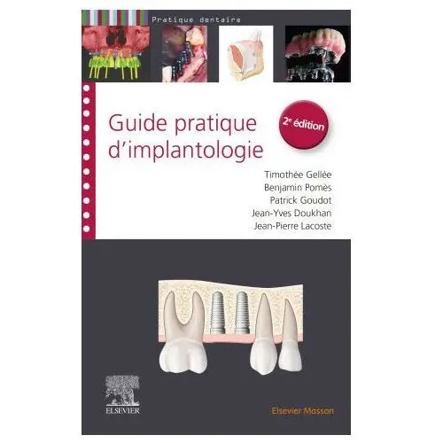 Guide pratique d'implantologie