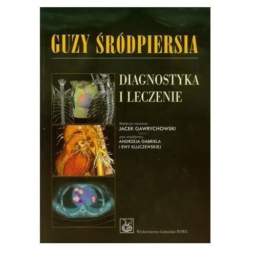 Guzy śródpiersia Diagnostyka i leczenie