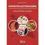 Hipercholesterolemia. Styl życia, dieta, leczenie Sklep on-line