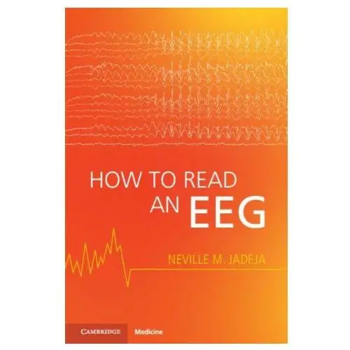 How to read an eeg Cambridge university press