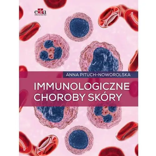 Immunologiczne choroby skóry