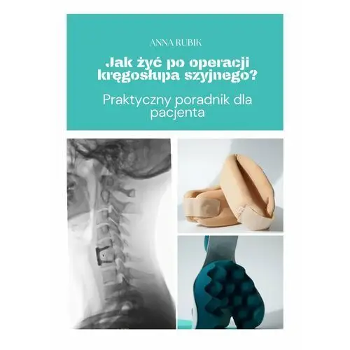 Jak żyć po operacji kręgosłupa szyjnego? Praktyczny poradnik dla pacjenta (E-book)