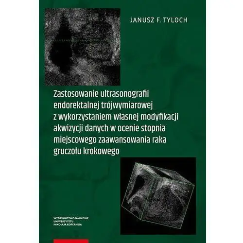 Janusz f. tyloch Zastosowanie ultrasonografii endorektalnej trójwymiarowej z wykorzystaniem własnej modyfikacji akwizycji danych w ocenie stopnia miejscowego zaawansowania raka gruczołu krokowego