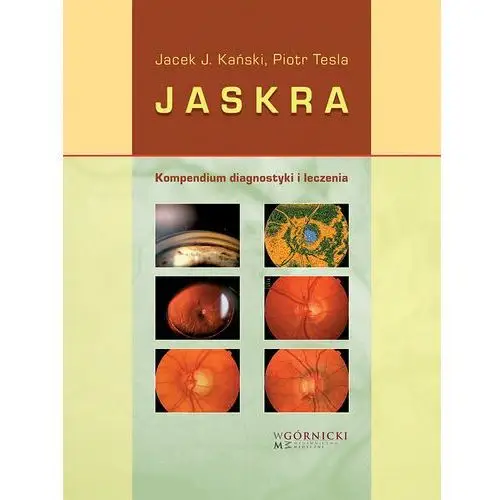 Jaskra. Kompendium diagnostyki i leczenia