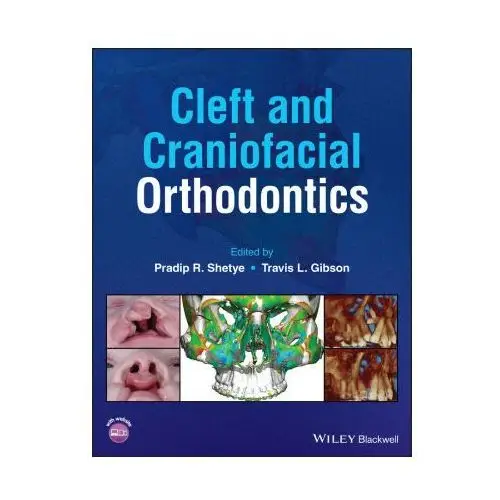 Cleft and Craniofacial Orthodontics