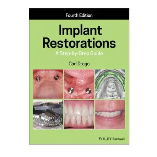 Implant Restorations