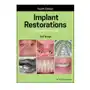 Implant Restorations Sklep on-line