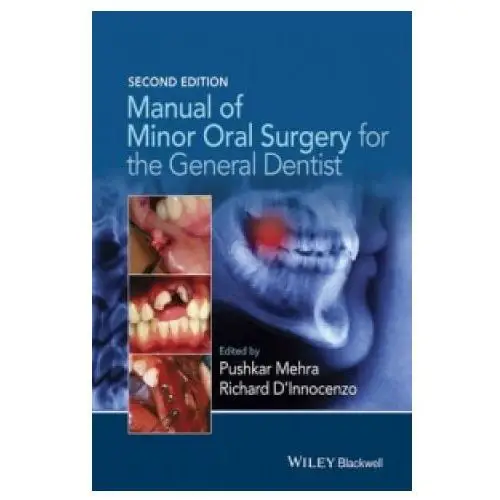 John wiley & sons inc Manual of minor oral surgery for the general dentist 2e