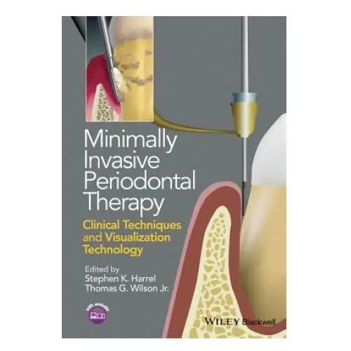 John wiley & sons inc Minimally invasive periodontal therapy - clinical techniques and visualization technology
