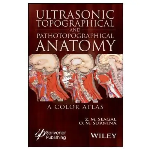 Ultrasonic topographical and pathotopographical anatomy - a color atlas John wiley & sons inc