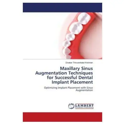 Lap lambert academic publishing Maxillary sinus augmentation techniques for successful dental implant placement