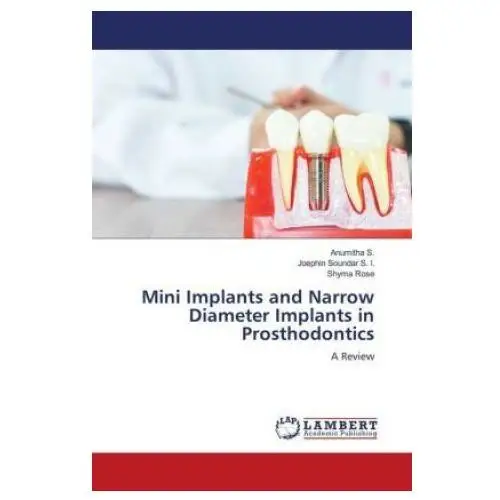 Lap lambert academic publishing Mini implants and narrow diameter implants in prosthodontics