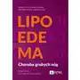 Lipoedema. Choroba grubych nóg. Podejście interdyscyplinarne Sklep on-line