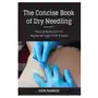 Lotus publishing Concise book of dry needling Sklep on-line