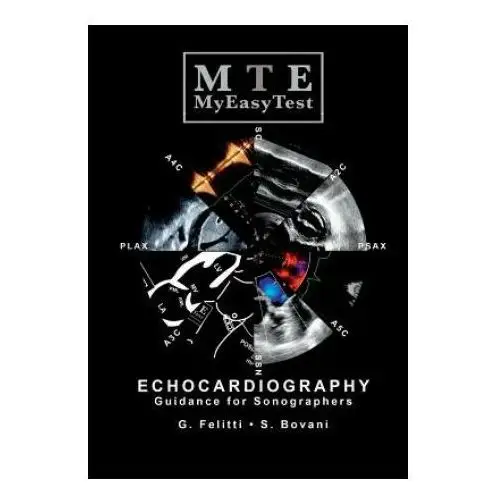 Echocardiography - MyEasyTest