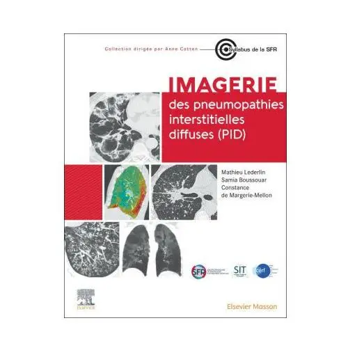 Imagerie des pneumopathies interstitielles diffuses (pid) Masson