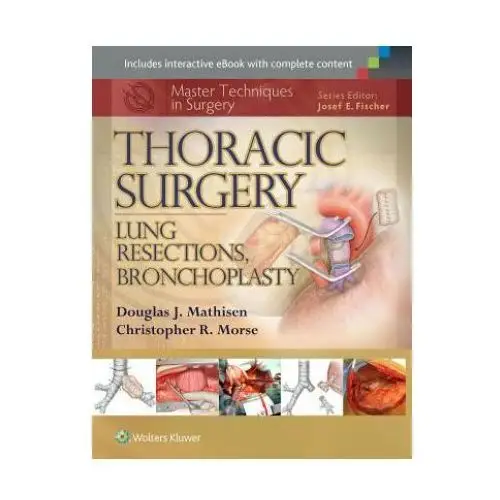 Master techniques in surgery: thoracic surgery: lung resections, bronchoplasty Lippincott williams and wilkins