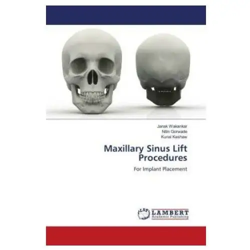 Maxillary sinus lift procedures Lap lambert academic publishing