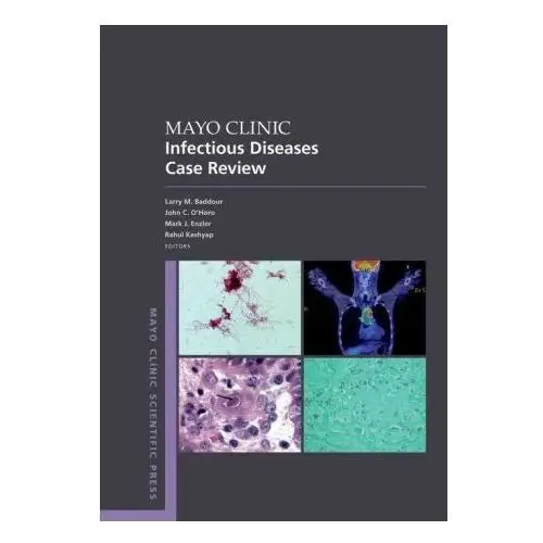 Mayo Clinic Infectious Disease Case Review