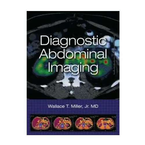 Mcgraw-hill education - europe Diagnostic abdominal imaging