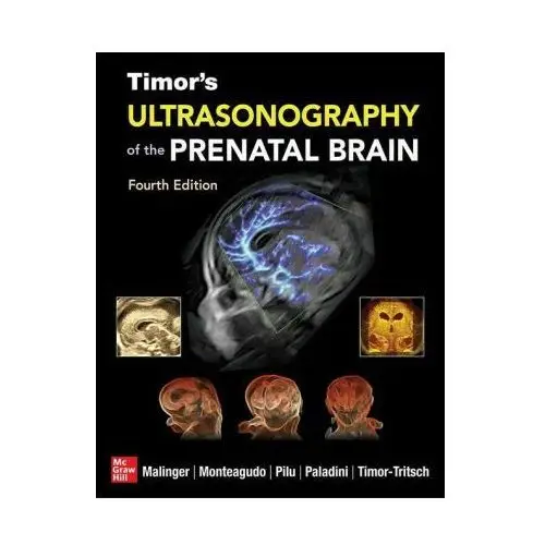 Mcgraw-hill education Timor's ultrasonography of the prenatal brain, fourth edition