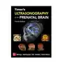 Mcgraw-hill education Timor's ultrasonography of the prenatal brain, fourth edition Sklep on-line