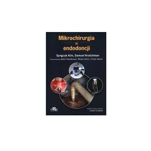 Mikrochirurgia w endodoncji