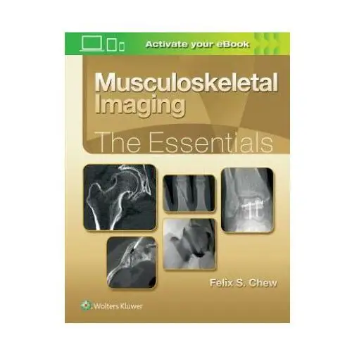 Musculoskeletal Imaging: The Essentials