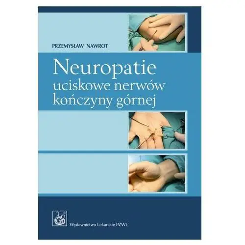 Neuropatie uciskowe nerwów kończyny górnej Nawrot Przemysław