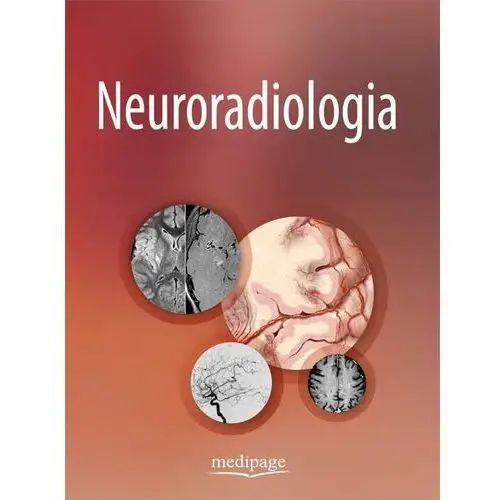 Neuroradiologia