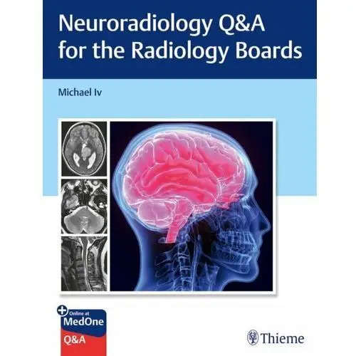 Neuroradiology Q&A for the Radiology Boards