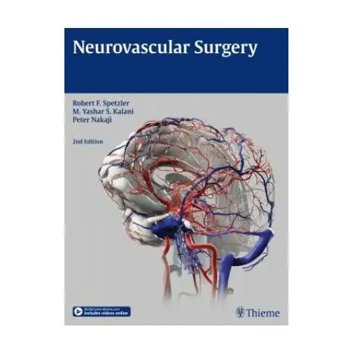 Neurovascular Surgery