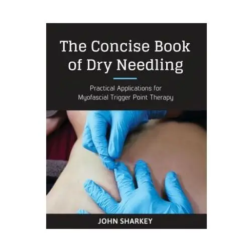 North atlantic books,u.s. Concise book of dry needling