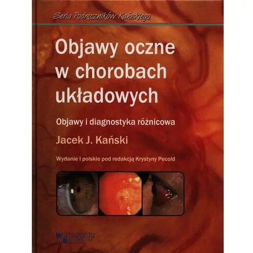 Objawy oczne w chorobach układowych