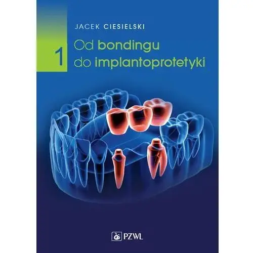 Od bondingu do implantoprotetyki Część 1 (E-book)